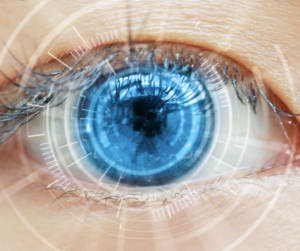 lasik eye surgery for teenagers