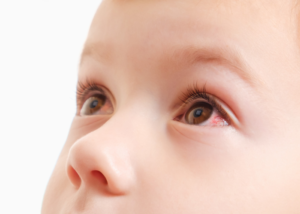 best pediatric eye doctor in NJ