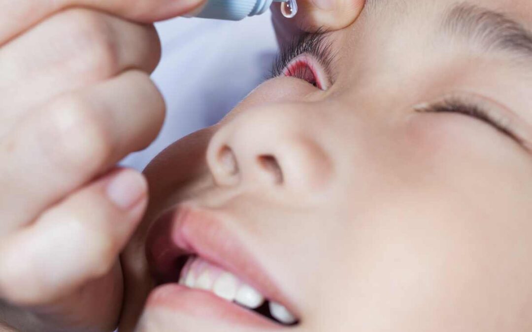 Atropine Eye Drops: Combating Childhood Myopia