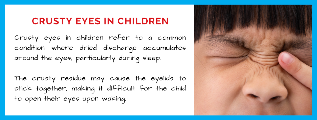 crusty-eyes-in-children-what-every-parent-needs-to-know