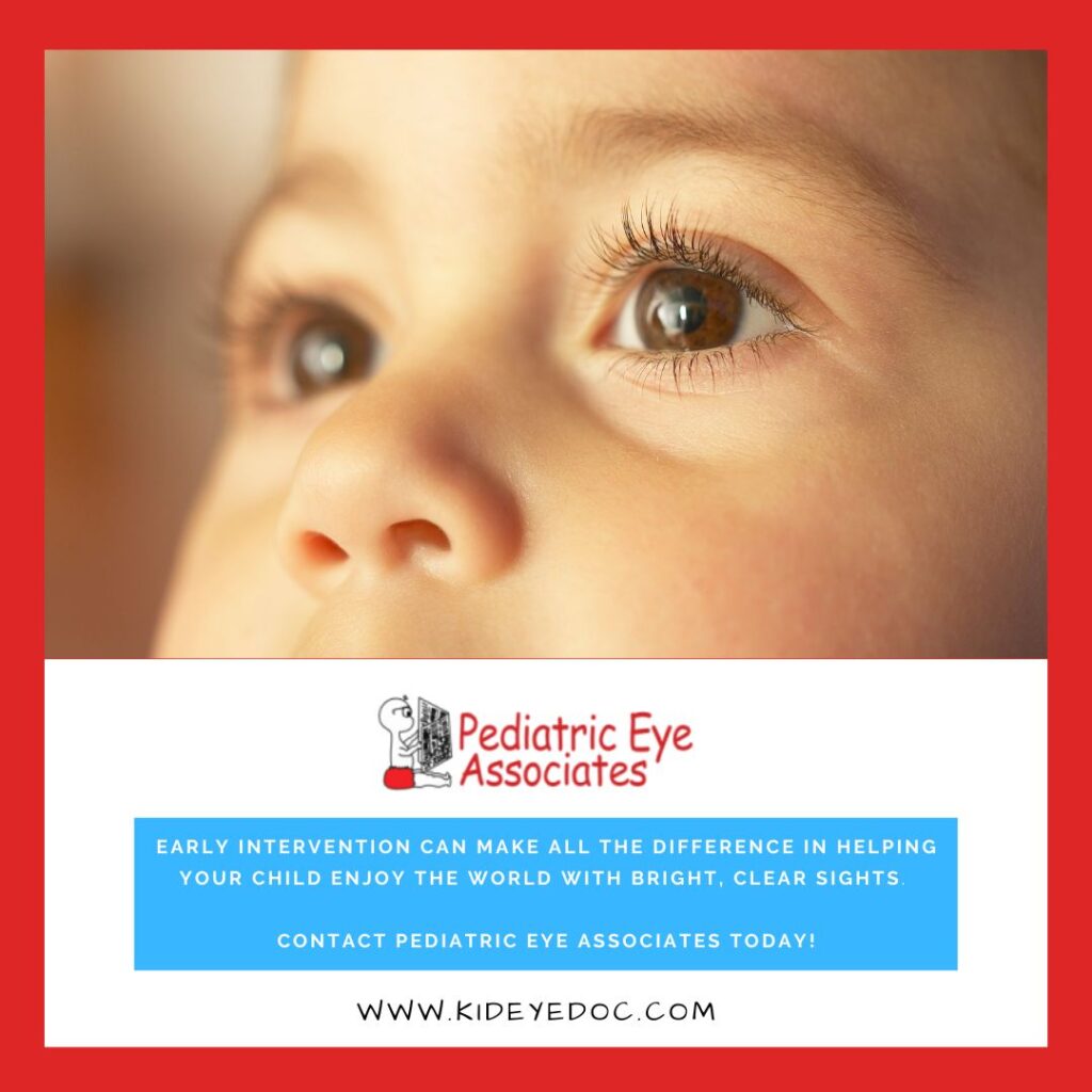 A Parent’s Guide on Pediatric Nerve Palsies/Ocular Nerve Disorders