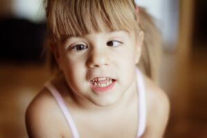 Lazy Eye (Amblyopia) vs. Crossed Eyes (Strabismus): Differences, Causes, and Treatment